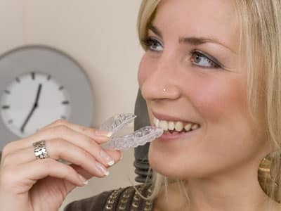 clear aligners franklin